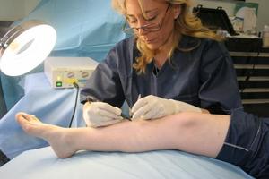 electrolysis hair removal